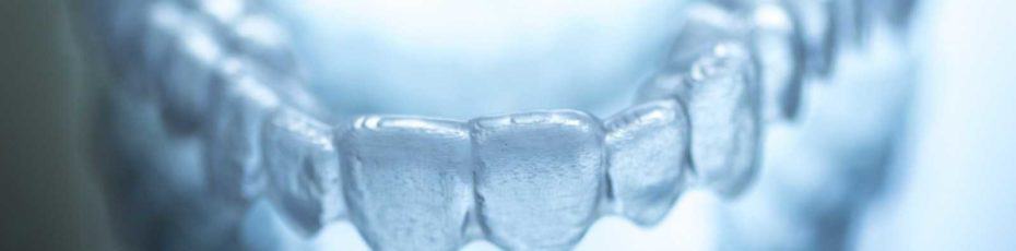 what you should know about invisalign