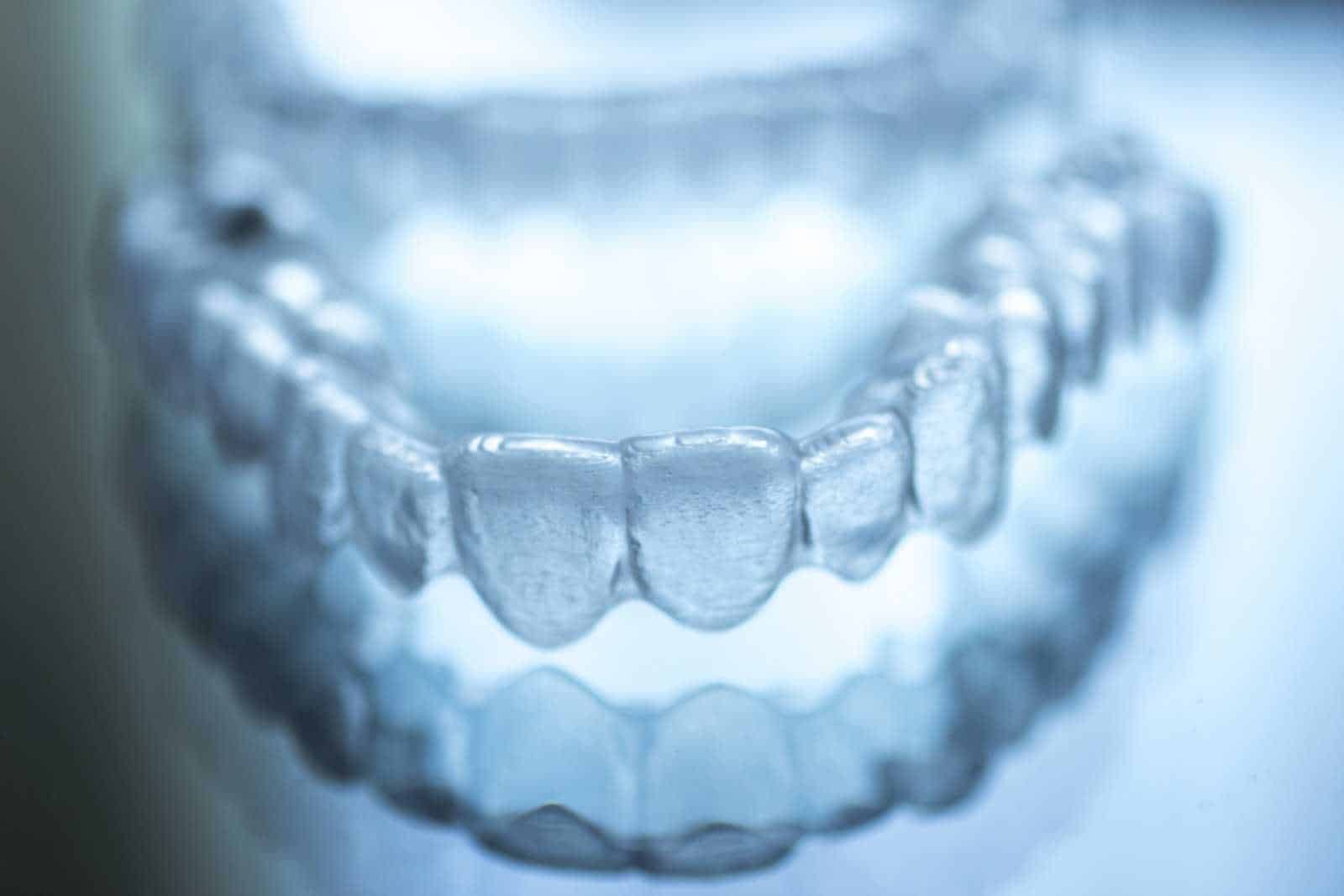 what you should know about invisalign