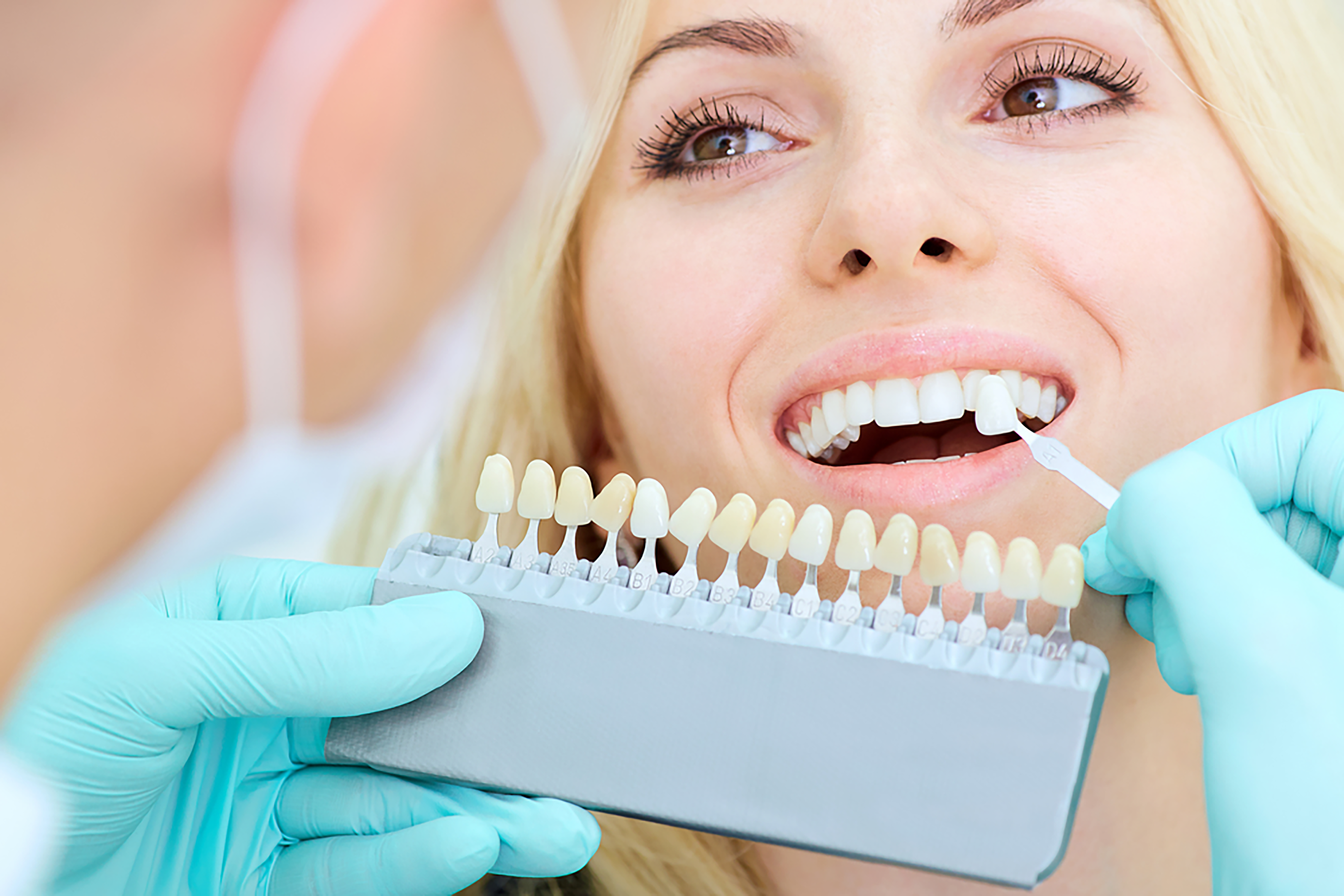 must know facts about teeth whitening