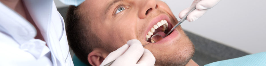 misconceptions about porcelain veneers