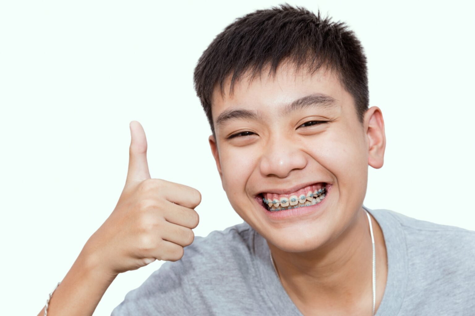 are-traditional-braces-better