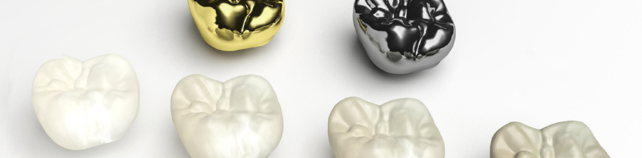 can crowns improve your smile