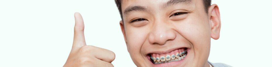 are-traditional-braces-better