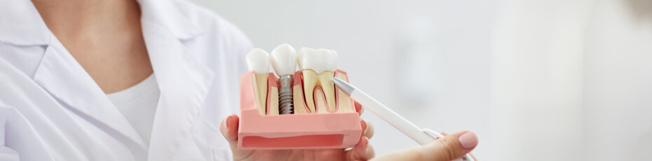 are dental implants safe for people with autoimmune disorders