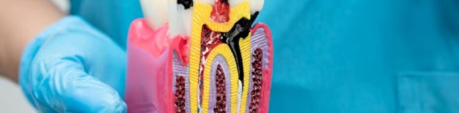 How Root Canals Help Save Natural Teeth from Extraction