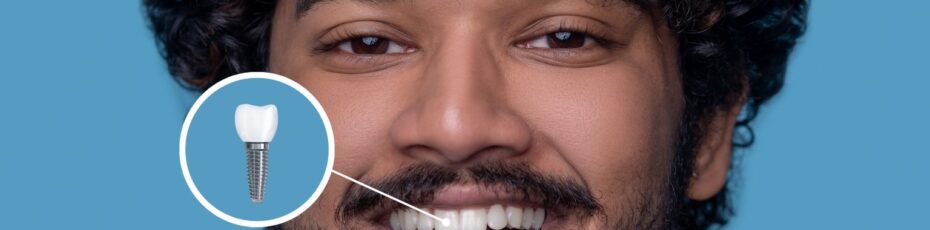 Are Dental Implants Painful? Myths vs Reality & How We Keep You Comfortable