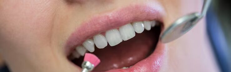 Who needs gum grafting 5 signs to look out for