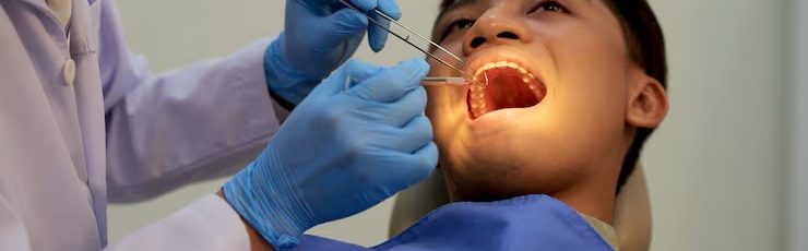 when do dentists recommend tooth removal