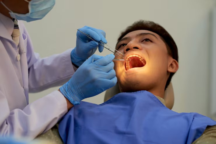 when do dentists recommend tooth removal